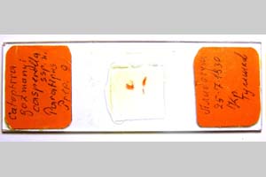 Catoptria gozmanyi casperella Ganev, 1983 [паратип NMNHSINV0323] (3) (c) Национален природонаучен музей, БАН — Колекция Безгръбначни животни (NMNHS-INV)